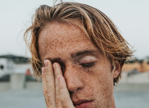 Ein gestresst wirkender junger Mann mit Sommersprossen fässt sich ins Gesicht.