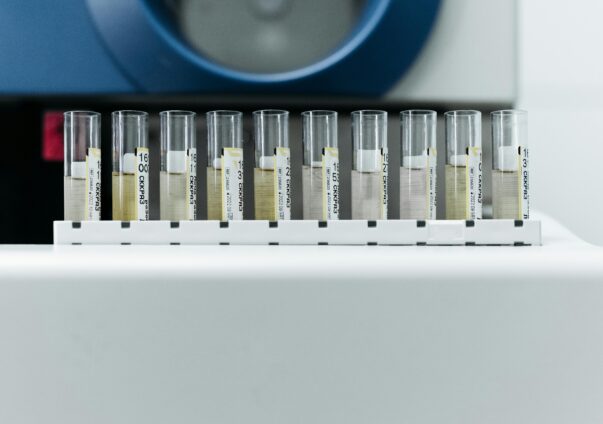 Medical test tubes with samples in a laboratory, prepared for urgent analysis.