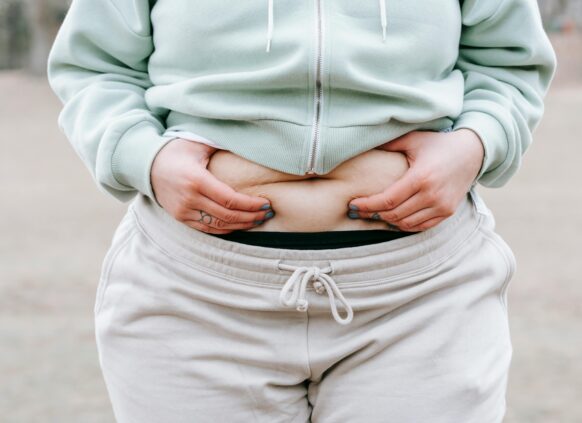 Person in casual clothes holding belly fat with both hands outdoors