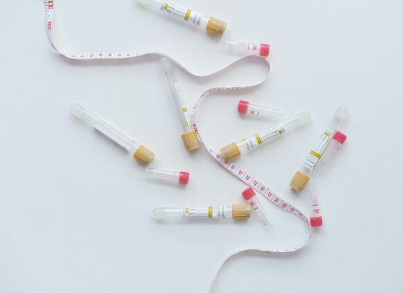 Scattered blood sample tubes and a measuring tape on a white background, symbolizing health diagnostics.